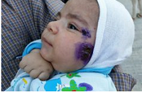 سه هزار نفر قربانی سالک در شرق اصفهان/ روستایی هزار نفری با ۳۰۰ آمار مبتلا